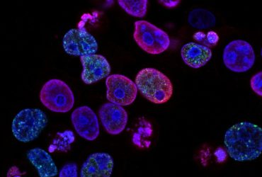 Cellules cancéreuses colorectales humaines traitées avec un inhibiteur de la topoisomérase et un inhibiteur de la protéine kinase ATR